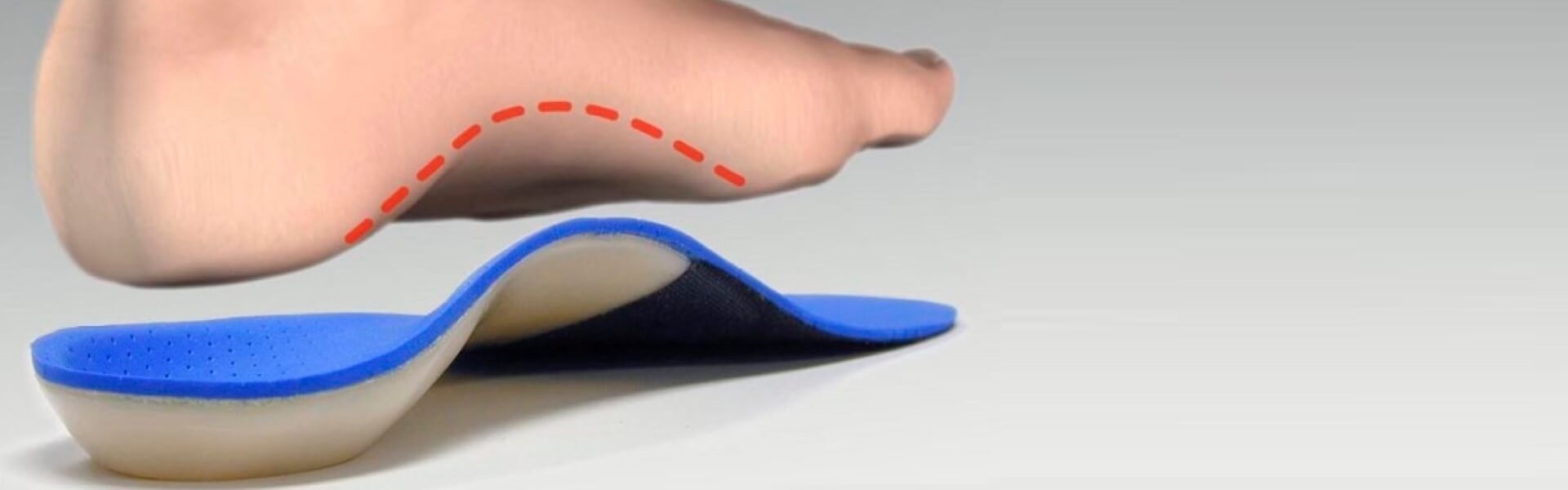 High Arch Feet, Supinated Foot in Kids 
